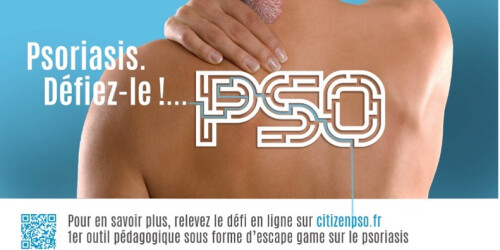 « Psoriasis. Défiez-le ! » pour éviter l’errance thérapeutique