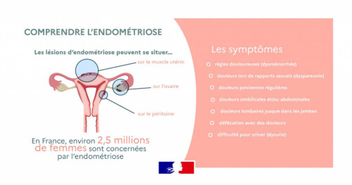 Endométriose : une maladie féminine, enfin prise en compte !